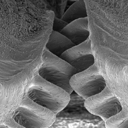 Gear teeth at the top of each hind leg of the plant hopper Issus coleoptratus. Photo © Malcolm Burrows 2013 (CC BY-NC-SA 3.0)
