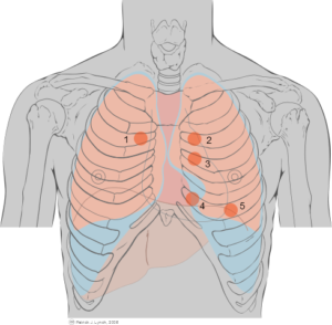 https://commons.wikimedia.org/wiki/File%3AThoracic_landmarks_anterior_view_heart_ausc.svg https://upload.wikimedia.org/wikipedia/commons/d/df/Thoracic_landmarks_anterior_view_heart_ausc.svg By Põnn [CC BY 2.5], via Wikimedia Commons 